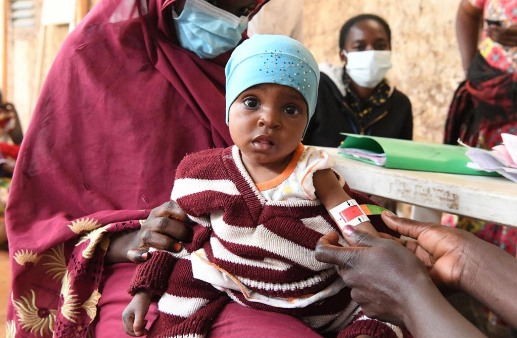 Burkina Faso / Santé : Quand la prise en charge nutritionnelle dépasse les attentes